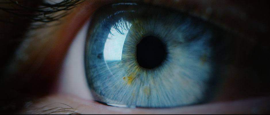 Eyeball with vision loss
