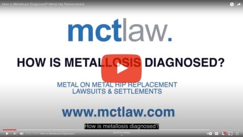 Video: How is metallosis diagnosed? 