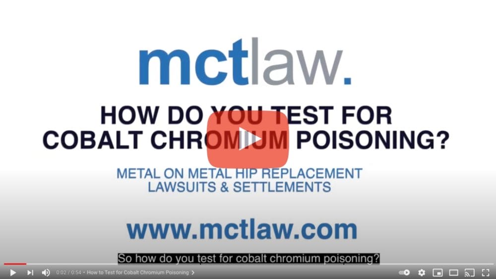 Cobalt Chromium Poisoning Metal Hip Replacements   How Do You Test For Cobalt Chromium 